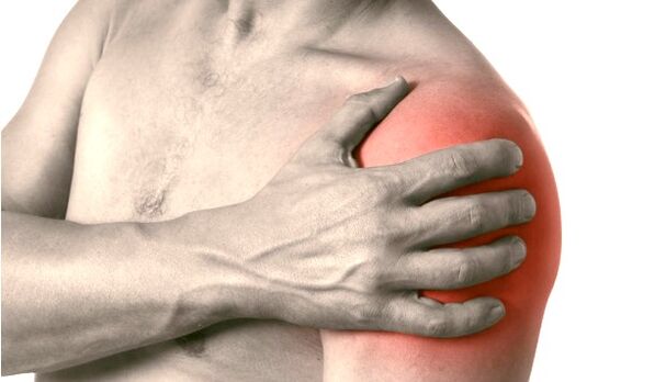 Swollen, red and enlarged shoulder - symptoms of arthrosis of the shoulder joint 2-3 degree