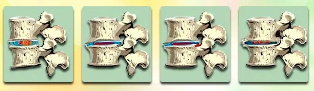 The stages of development degenerative disc disease