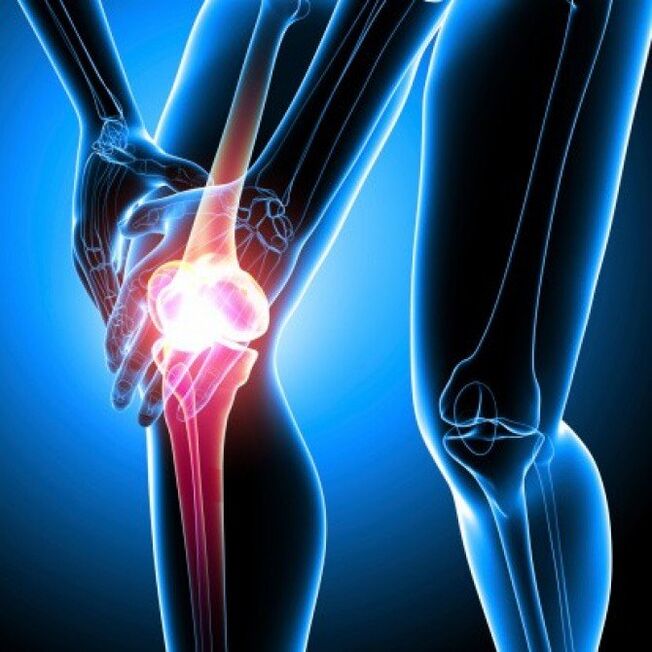 Advanced rheumatoid arthritis can cause pain in the hip joint