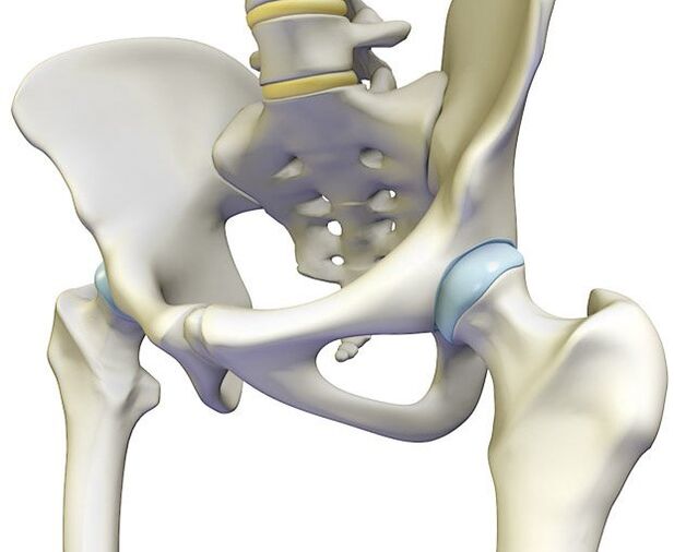Osteochondrosis provokes acute pain in the hip joint